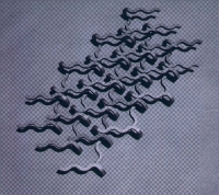 Zs - Xe (CD)